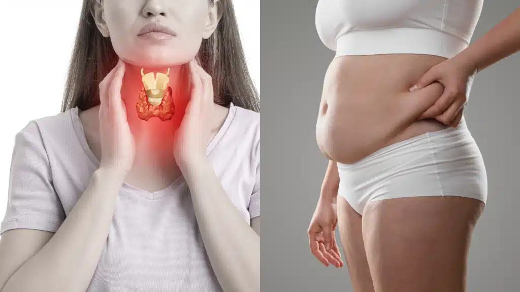 The Hidden Link Between Thyroid Issues and Weight Gain - Med Matrix functional medicine blog